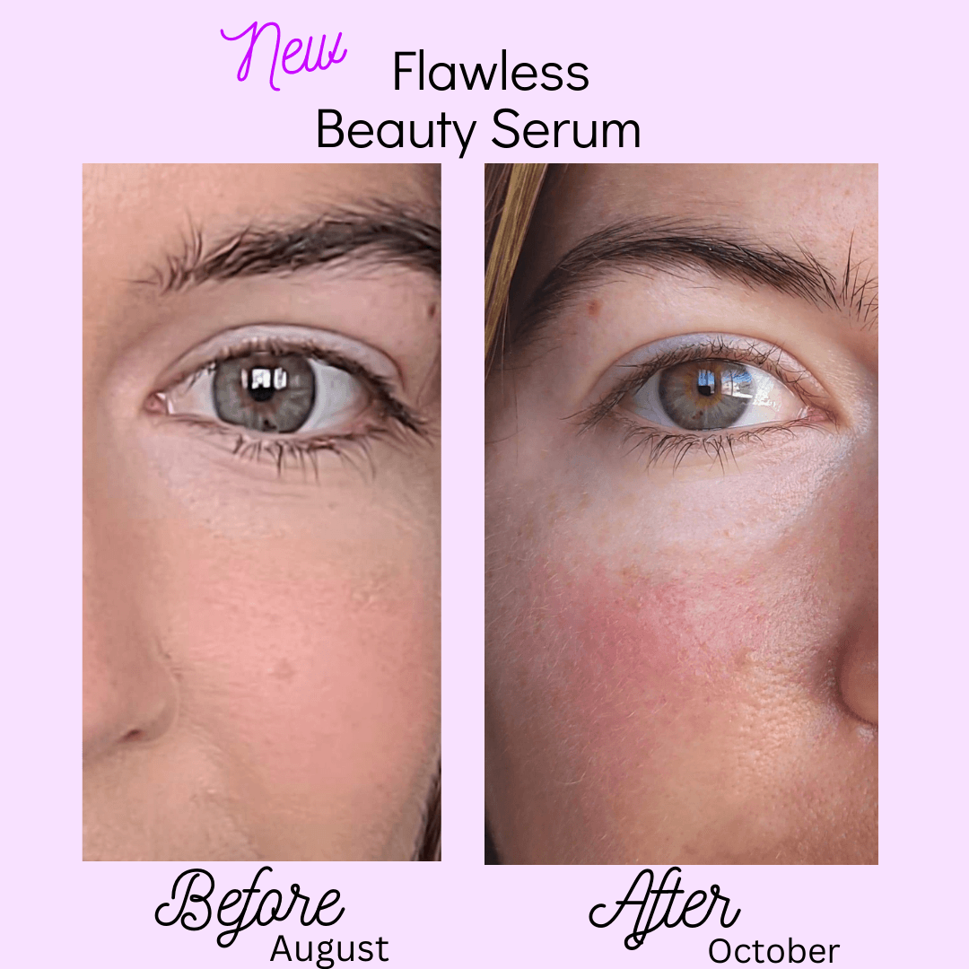 Before and After of the Flawless beauty serum on the same eye