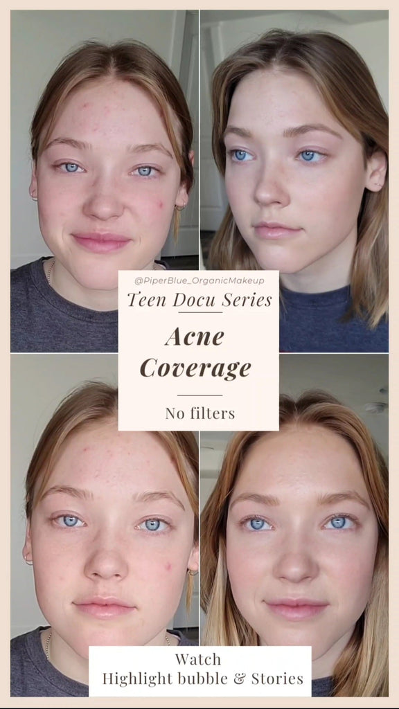 Teen Docu Series - Acne and Blemish Coverage - PiperBlue Organic Makeup