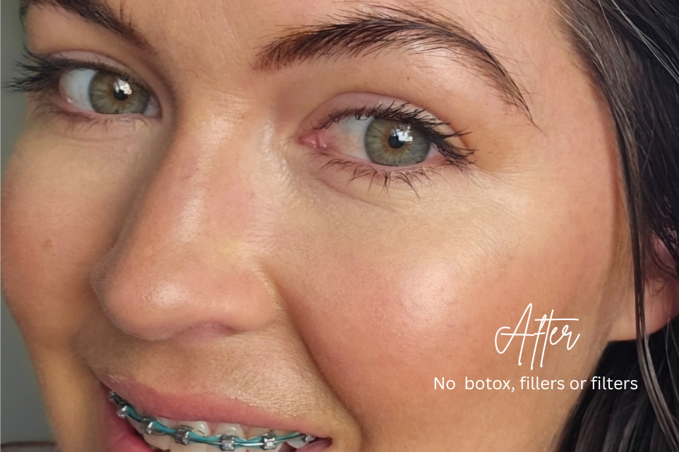 Elevated Age Defy Bundle