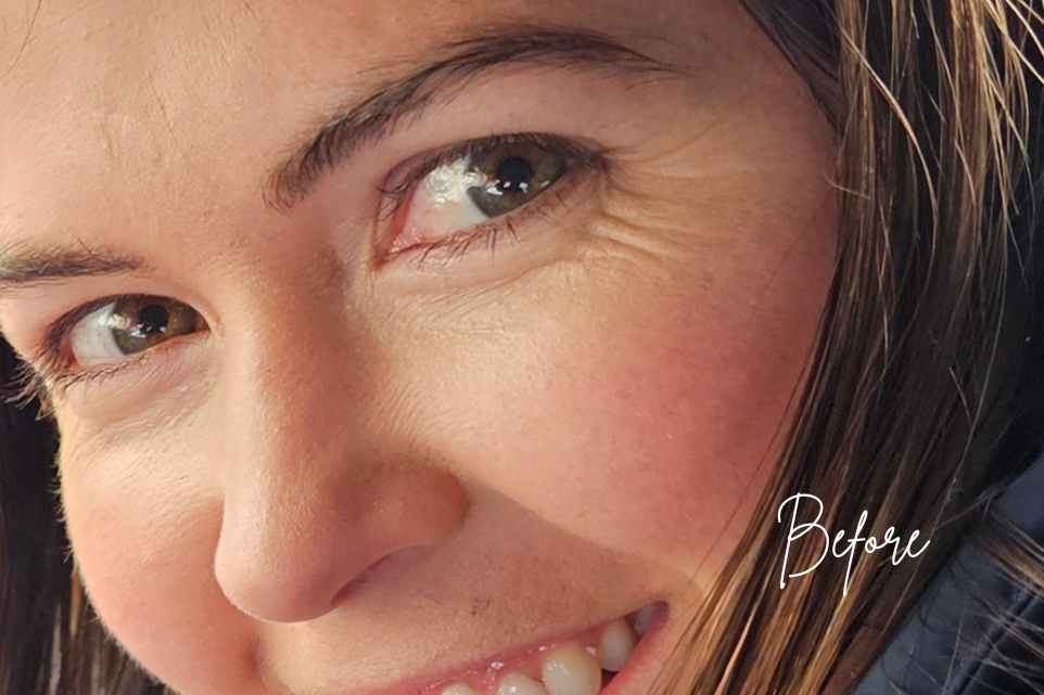 Elevated Age Defy Bundle